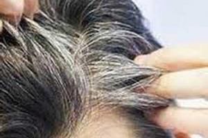 مصرف این غذاها مو را سفید میکند
