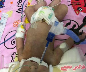 قصور پزشکی در بیمارستان برزویه گنبدکاووس جان نوزاد یک روزه را گرفت+عکس