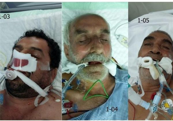 انتشار تصاویر 6 مجروح مجهول الهویه فاجعه منا/ خانواده‌ها در صورت شناسایی تماس بگیرند