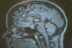  دانلود فیلم/خارج کردن جنین از مغز یک زن !