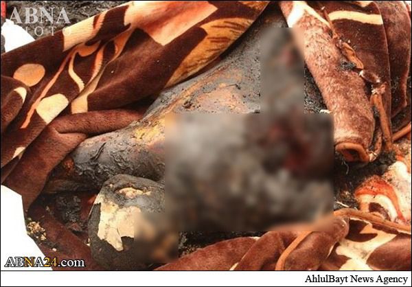 فیلم/سند جنایات آل سعود در یمن (+18)