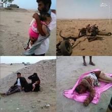 عکس(+18)/صفحه اینستاگرامی جنایات آل‌سعود در یمن