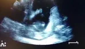 دانلود کلیپ/شادمانی جنین در شکم مادر !